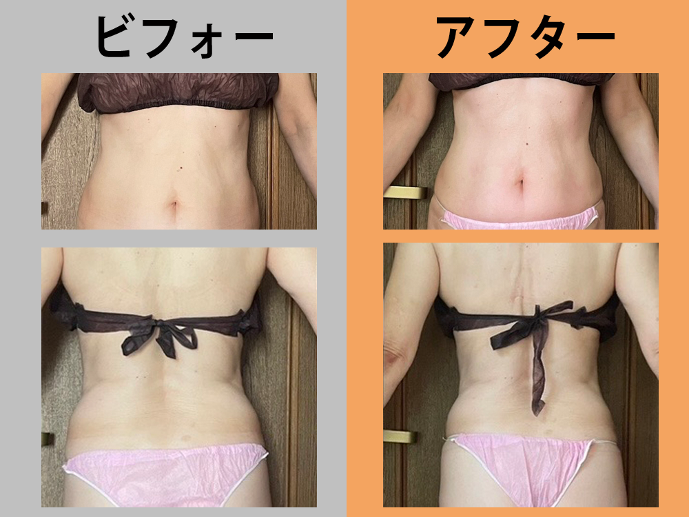 69歳女性