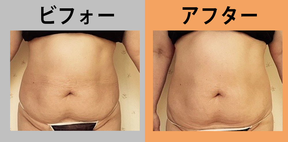 69歳女性