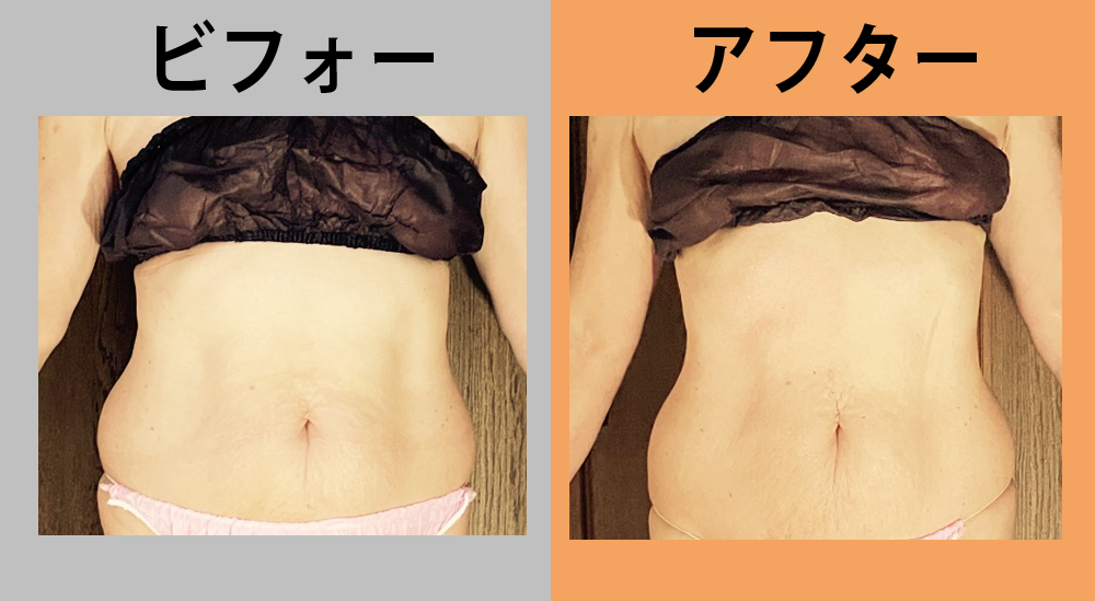 69歳女性